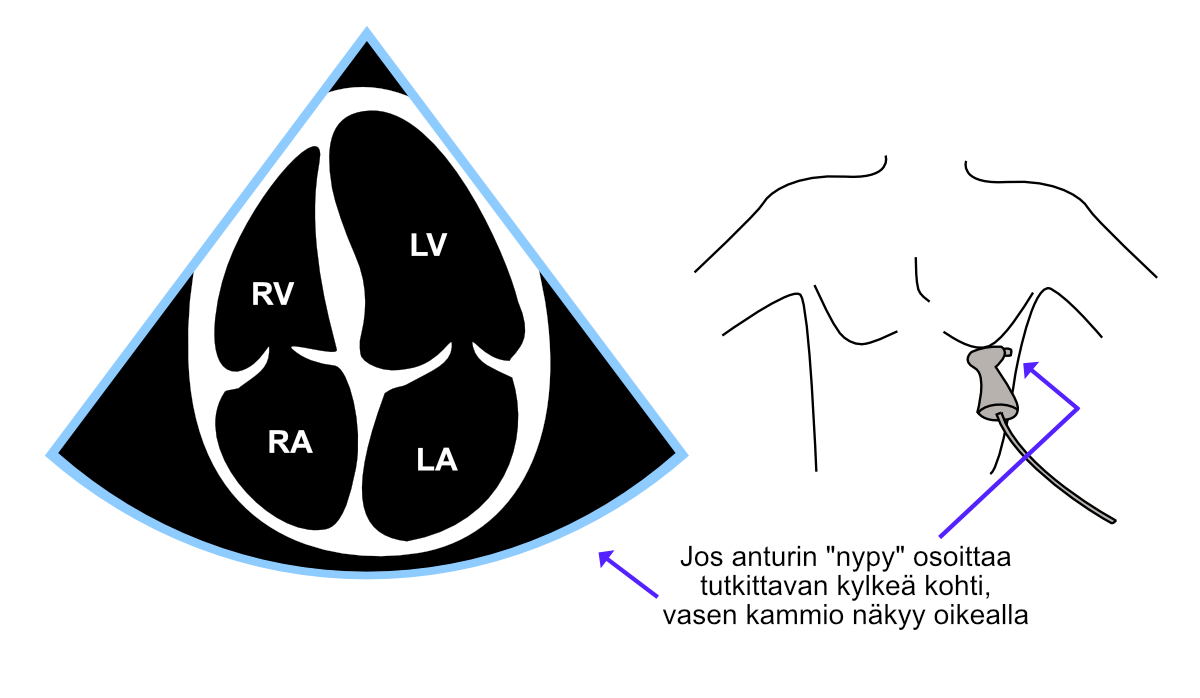 Nelilokerokuva (A4C) standardilla tavalla kuvannettuna.