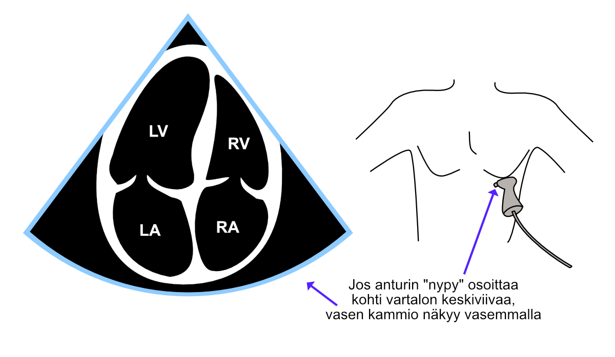 Nelilokerokuva (A4C) vaihtoehtoisella tavalla kuvannettuna.