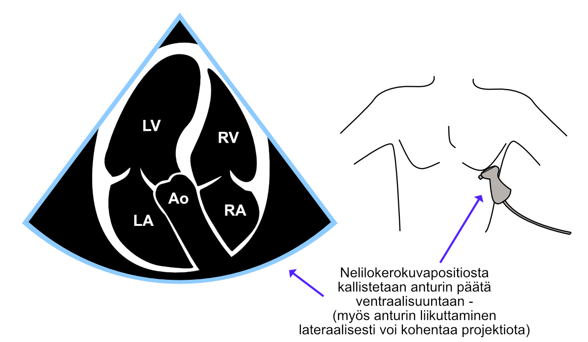 Viisilokerokuva (A5C).