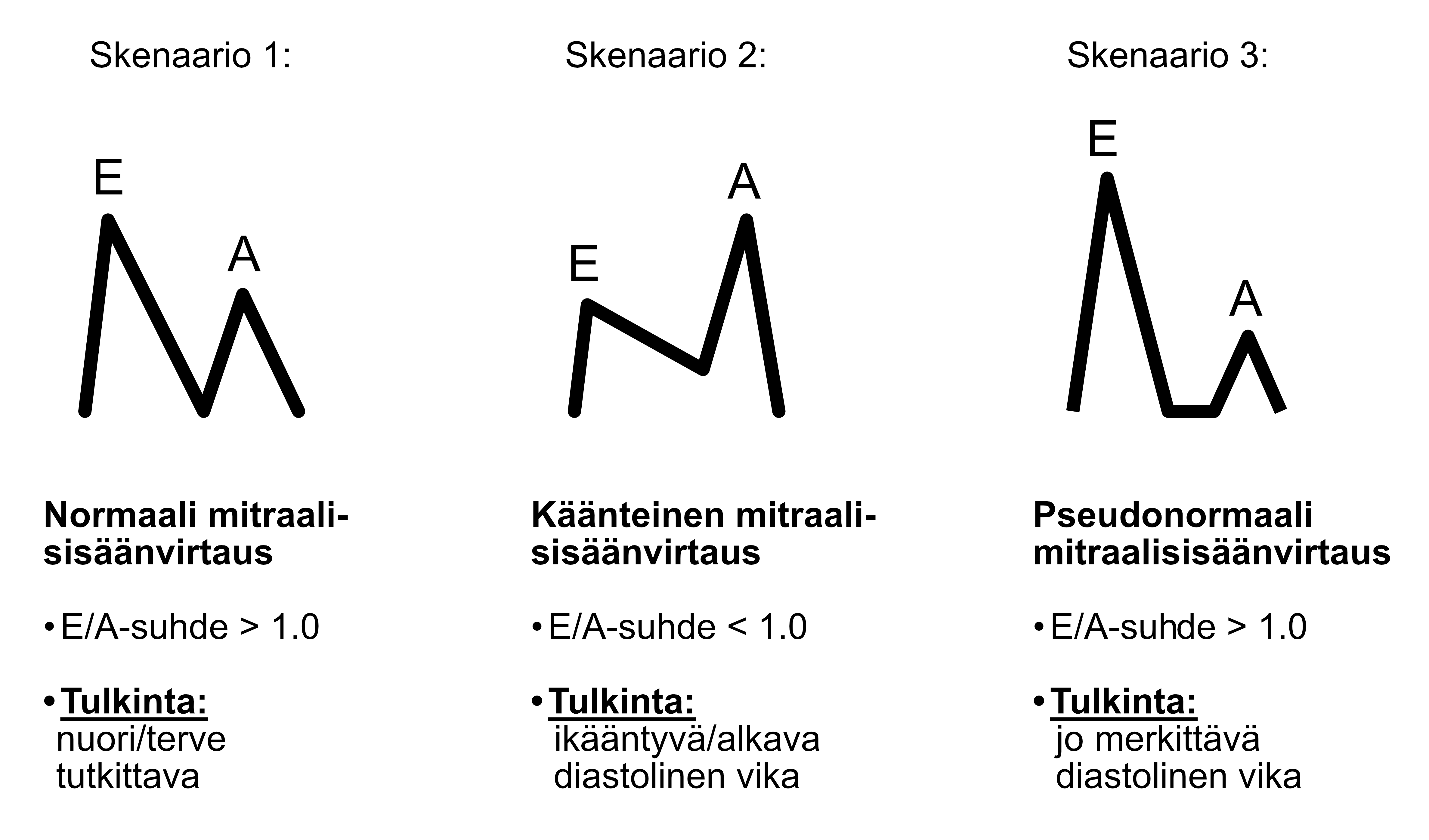 Mitraalisisäänvirtauksen eri skenaariot.