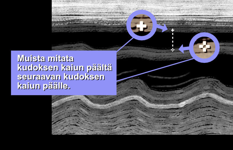 Muista aina mitata kudoksen päältä kudoksen päälle (sydämen kudos näkyy harmaana, ei mustana).