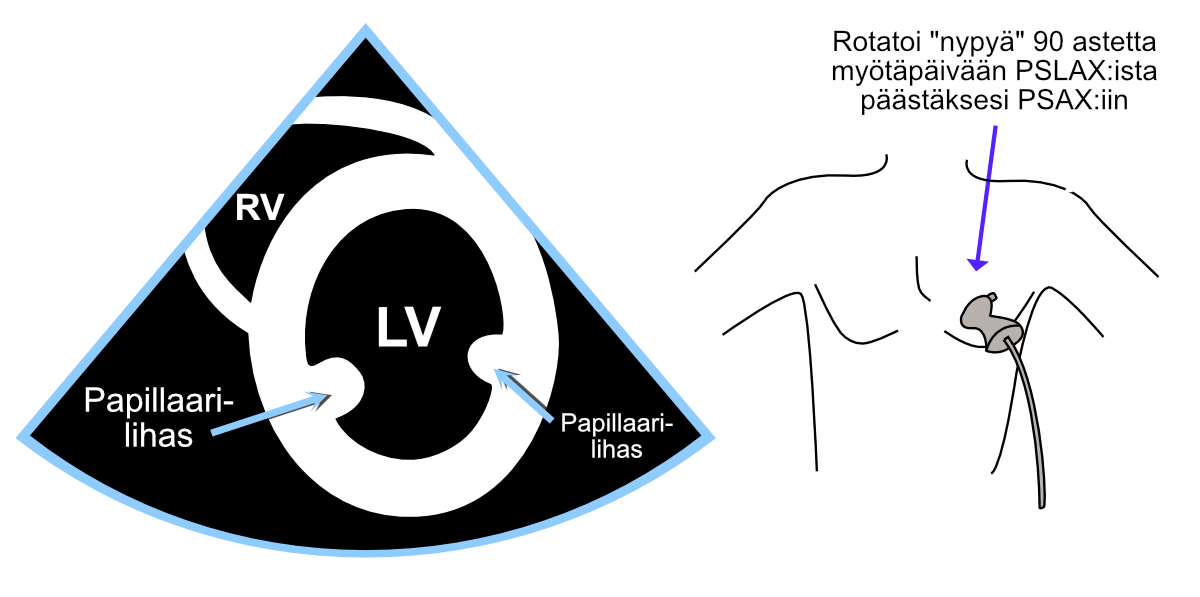 Parasternaalinen lyhyen akselin projektio (PSAX).
