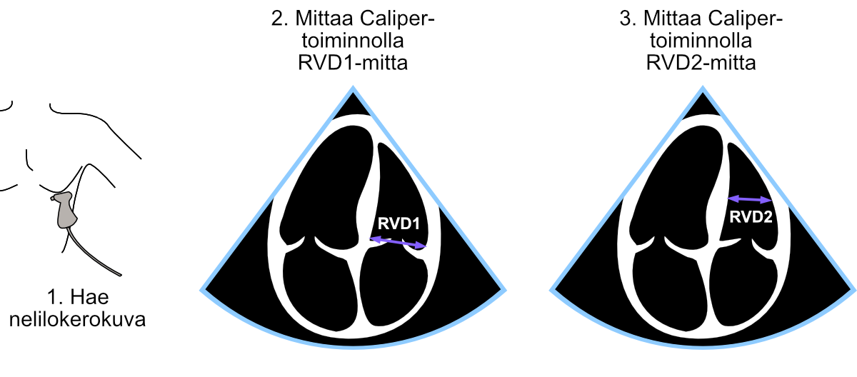 RVD1- ja RVD2-mittausten suoritus.
